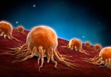 Suntem ultimii din UE la monitorizarea diverselor tipuri de cancer