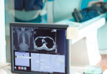 Petrișor Peiu: Suntem ultimii din UE la monitorizarea diverselor tipuri de cancer