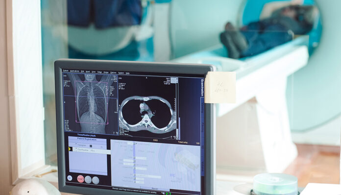 Petrișor Peiu: Suntem ultimii din UE la monitorizarea diverselor tipuri de cancer