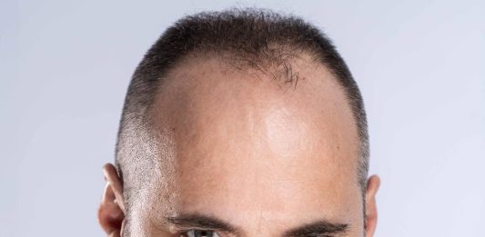Silviu Mănăstire acuză manipularea prin sondajele comandate de Bolojan!